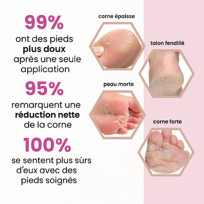 DouxTalons™ - Talons lisses en 2 minutes